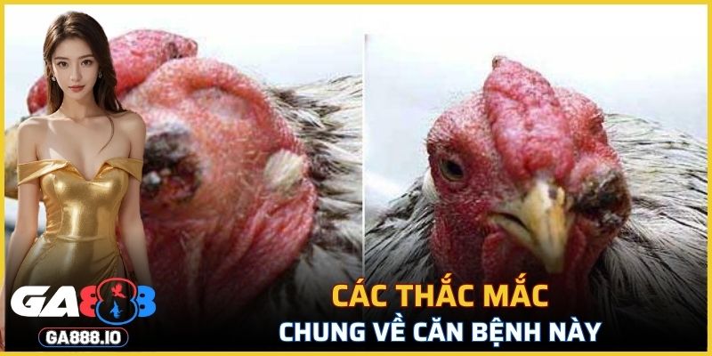 Các thắc mắc chung về căn bệnh này